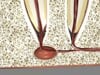 Root Canal